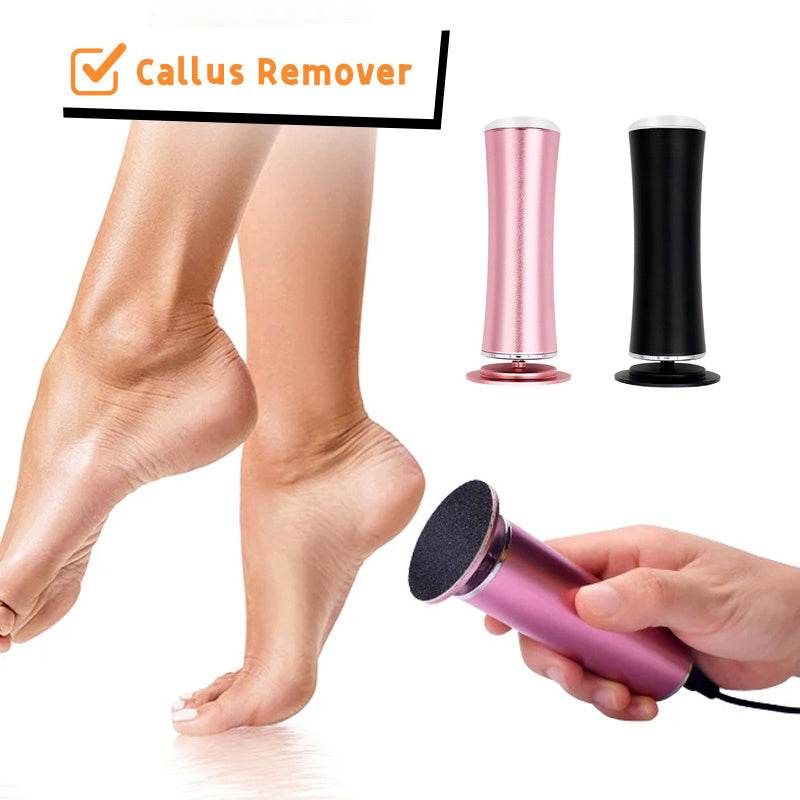 Electric Foot Callus Remover - Emprize360